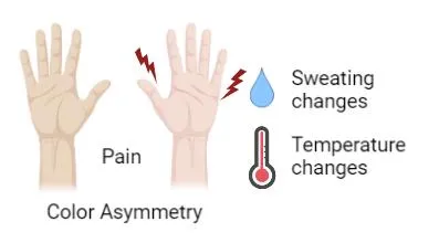 Illustration of two hands labelled Pain, Color Asymmetry, Sweating changes and Temperature changes