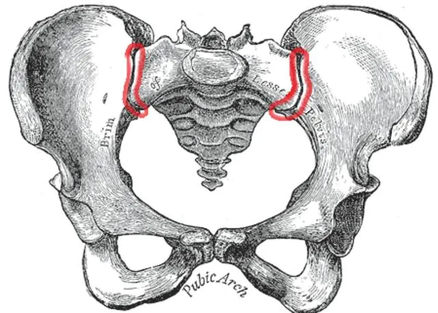 Drawing of the pelvis with both sacroiliac joints outlined in red