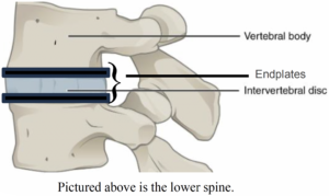 What is Basivertebral Nerve Ablation